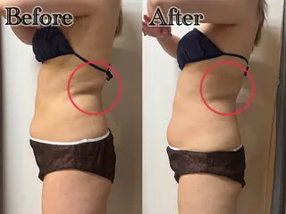 六本木脱毛andS 店長Sachiのエステ・リラクイメージ