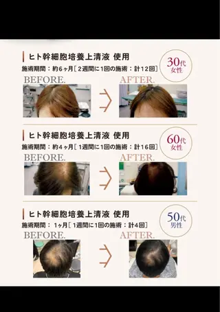 美容と育毛のサロン Link　松浦のマツエク・マツパデザイン