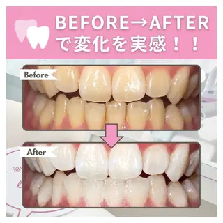 ホワイトニング/脱毛 専門店エクシア岡崎店のその他イメージ