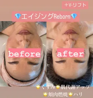 Tipani beaute'のエステ・リラクイメージ