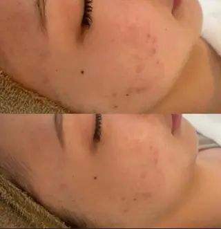 中目黒ハーブピーリン グ🌿ララピールのエステ・リラクイメージ