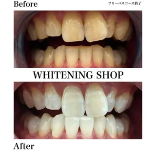 ホワイトニング ショップ伊丹店のその他イメージ