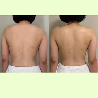 spaHINOKI 【女性専用】のエステ・リラクイメージ