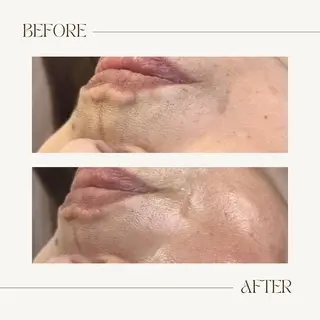 1st｜フェイシャル エステ専門店のエステ・リラクイメージ