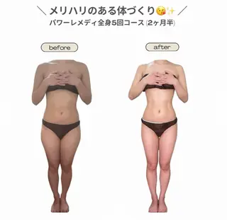 《本気痩せ×疲労改善 》  BILOOPのエステ・リラクイメージ