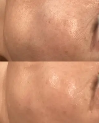 La･Bellvie 【星ヶ丘店]のエステ・リラクイメージ