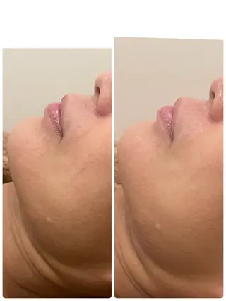 メナード片町 やまもと みくのエステ・リラクイメージ