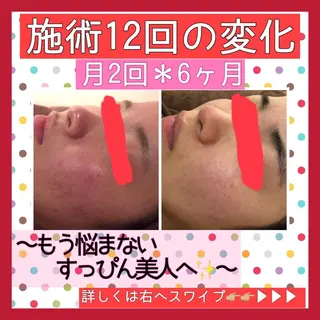 ミディアム カラー パーマ ヘアアレンジ メンズ キッズ ネイル マツエク・マツパ ニキビ・肌質改善専門 ♡人生が変わるサロンのエステ・リラクイメージ