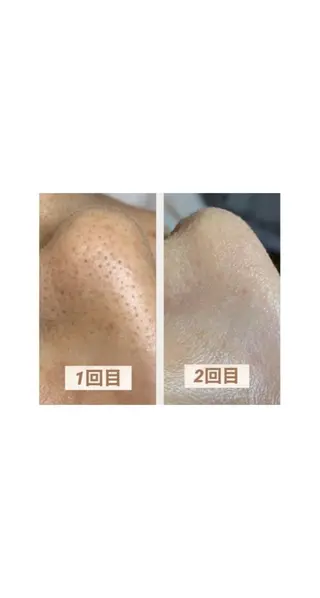 松下 千恵のネイルデザイン