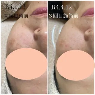 エステティック Nanagiのエステ・リラクイメージ