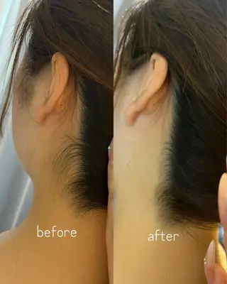 うなじ脱毛/美肌脱毛 LABELのエステ・リラクイメージ