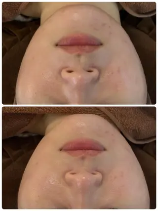 FLEUR 2号店のエステ・リラクイメージ