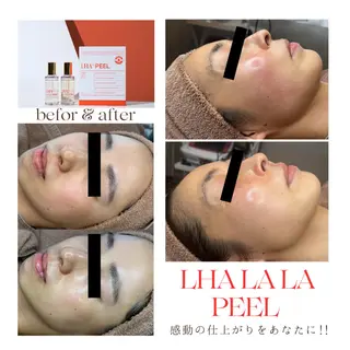 【感動のハリ・ツヤ】 美肌＆脱毛SPICAのエステ・リラクイメージ