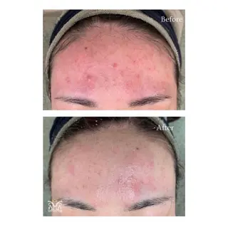 Bellmore ＋のエステ・リラクイメージ