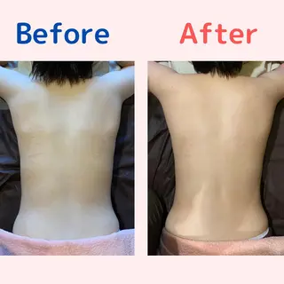 Rewhite -リホワイト-のエステ・リラクイメージ