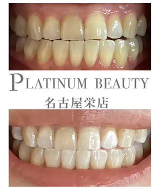 プラチナムビューティ 名古屋栄のその他イメージ