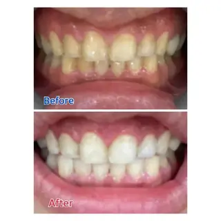 M渋谷 ホワイトニングのエステ・リラクイメージ