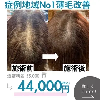 シミ・若返り特化 さゆみのエステ・リラクイメージ