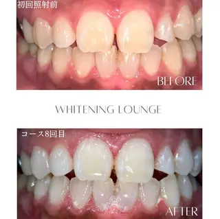 ホワイトニング Lounge横須賀のエステ・リラクイメージ