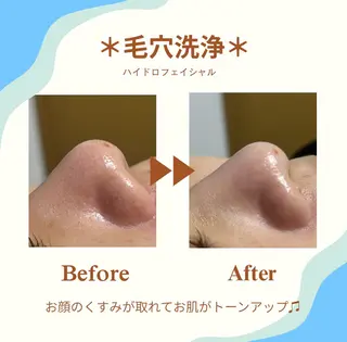 White labo 今村のエステ・リラクイメージ