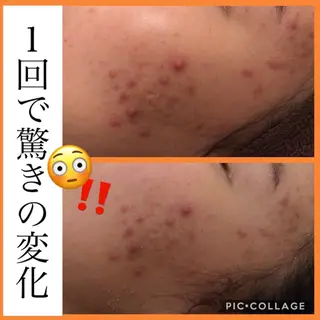 ミディアム カラー パーマ ヘアアレンジ メンズ キッズ ネイル マツエク・マツパ ニキビ・肌質改善専門 ♡人生が変わるサロンのエステ・リラクイメージ