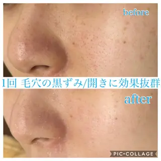 ロング カラー パーマ ヘアアレンジ キッズ ネイル マツエク・マツパ EnsorClair 代表 野口真央のエステ・リラクイメージ