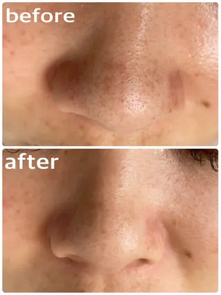 une所属・une mizuhoの眉毛・アイブロウイメージ