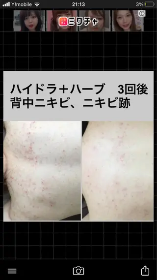 セミロング カラー パーマ ヘアアレンジ メンズ キッズ ネイル マツエク・マツパ アイブロウ ハーブピーリング専門 🌿モッカのエステ・リラクイメージ