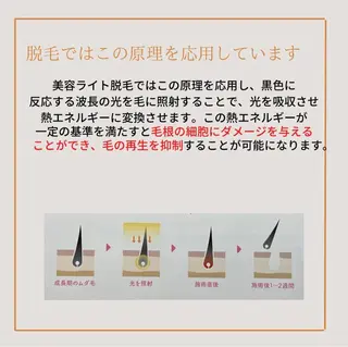 calimero 美肌脱毛サロンの眉毛・アイブロウイメージ