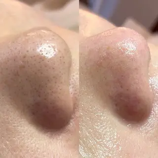 毛穴・頭皮 専門店💪のその他イメージ