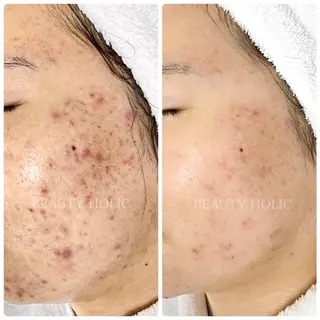 ビューティーホリック 東金店のエステ・リラクイメージ