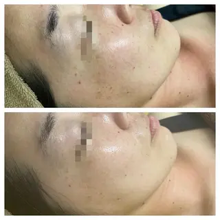 salon   de epilaのエステ・リラクイメージ