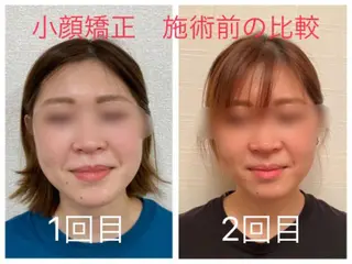 小顔矯正サロン Lilyのエステ・リラクイメージ