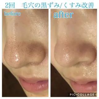 ロング カラー パーマ ヘアアレンジ メンズ ネイル マツエク・マツパ EnsorClair 代表 野口真央のエステ・リラクイメージ