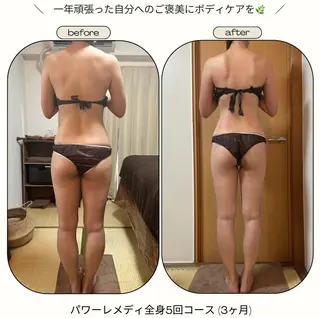 《本気痩せ×疲労改善 》  BILOOPのエステ・リラクイメージ