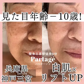 小尻・太もも痩せる パルタージュのエステ・リラクイメージ