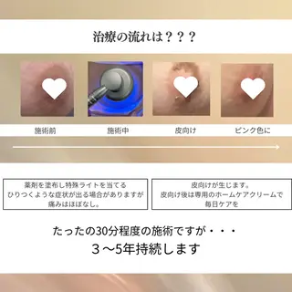 Raviy 【痩身専門・肌管理】のエステ・リラクイメージ