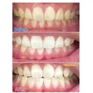 M渋谷 ホワイトニングのエステ・リラクイメージ