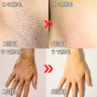 メンズ 都度払い制メンズ脱毛 オーナーのエステ・リラクイメージ