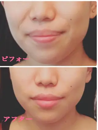 小顔サロン ソ.ルシエのエステ・リラクイメージ