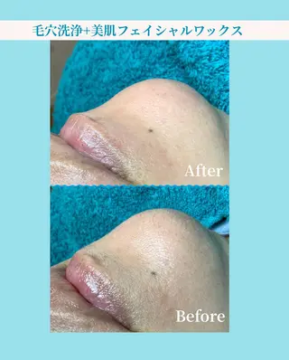 毛穴改善フェイシャル 夏秋美肌サロンのエステ・リラクイメージ