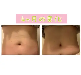 癒し腸もみサロン シャユーム　ゆきなのその他イメージ