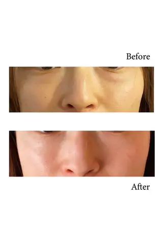 看護師が施術する美容 ナスサロ/☆田中☆のエステ・リラクイメージ