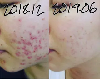 菊地 恵美のエステ・リラクイメージ