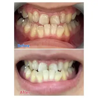 M渋谷 ホワイトニングのエステ・リラクイメージ