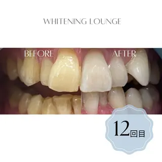 ホワイトニング Lounge横須賀のエステ・リラクイメージ