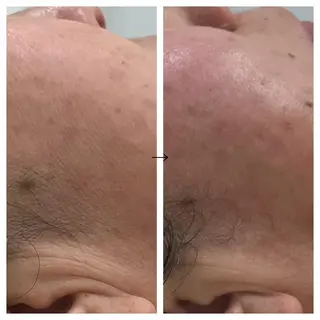 ビューティー ミロワールのエステ・リラクイメージ