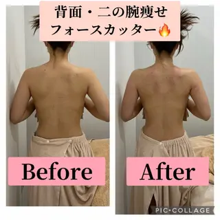 ブライダル痩身×脱毛 尼崎駅前サロンのエステ・リラクイメージ