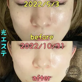 Rim リムのマツエク・マツパデザイン