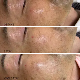 メンズ 歌舞伎町深夜サロン to mëのエステ・リラクイメージ